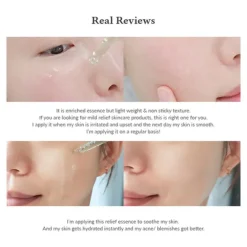 Skin Relief Essence